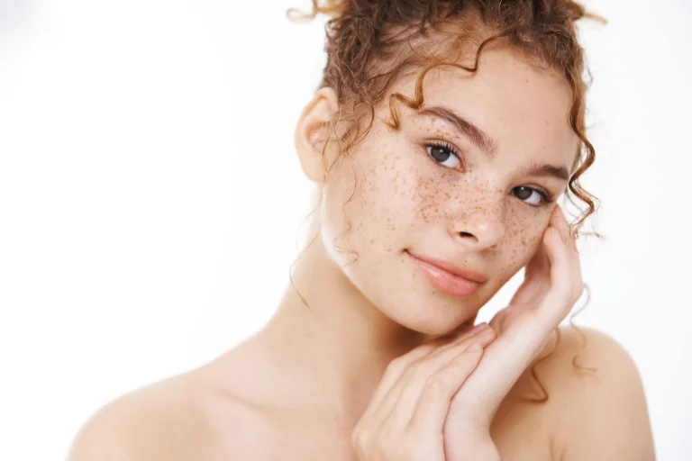 manchas-faciales-vibeofbeauty