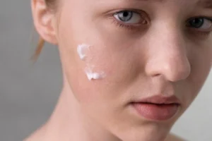 piel_reactiva_freepik_vibeofbeauty